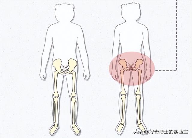 為啥女生的屁股兩側(cè)，會(huì)凹進(jìn)去？