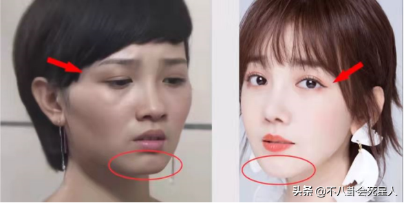 5位長(zhǎng)相土氣的女星，大刀闊斧下狠手，一步步將自己變成大美女