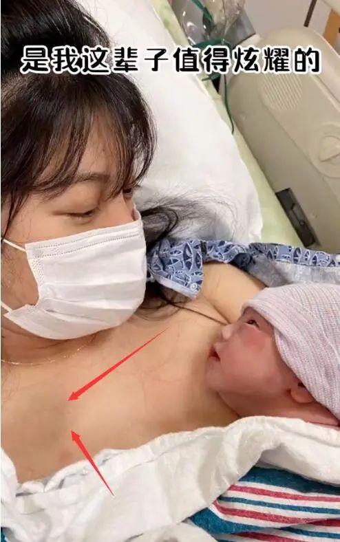 女星開奶胸前被揉致淤青:其實(shí)你完全不該受這個(gè)罪