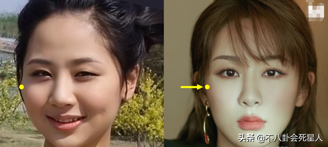5位長(zhǎng)相土氣的女星，大刀闊斧下狠手，一步步將自己變成大美女