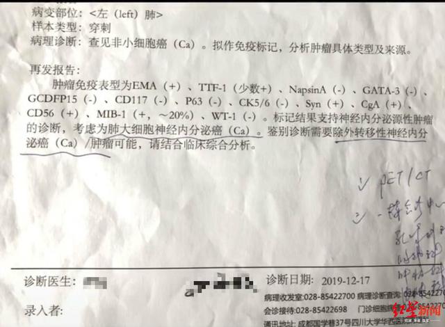 看哭了！28歲女子光頭出鏡記錄抗癌過程，希望大家重視健康