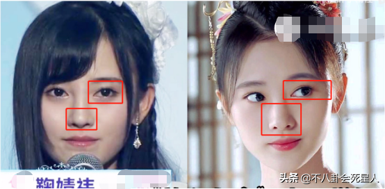 5位長(zhǎng)相土氣的女星，大刀闊斧下狠手，一步步將自己變成大美女