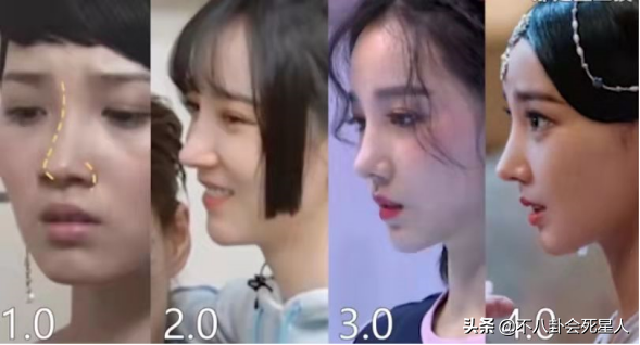 5位長(zhǎng)相土氣的女星，大刀闊斧下狠手，一步步將自己變成大美女