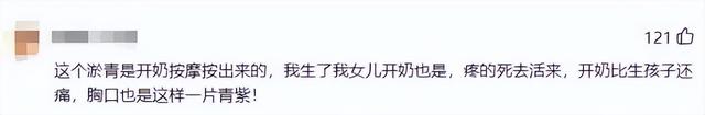 女星開奶胸前被揉致淤青:其實(shí)你完全不該受這個(gè)罪