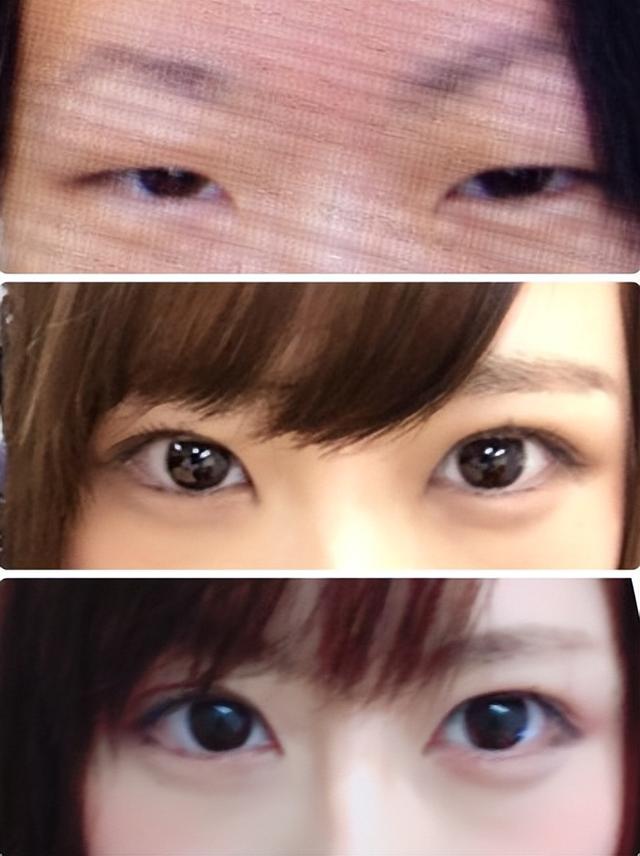 日本妹子因長得丑被欺凌，花400萬整成美女，神似“有村架純”