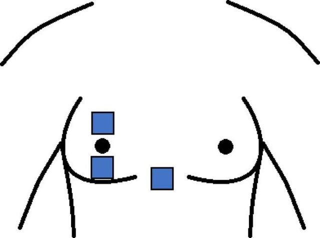 運(yùn)動(dòng)時(shí)胸部愛(ài)出汗？竟和罩杯有關(guān)？答案不是你想的那樣……