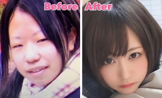日本妹子因長得丑被欺凌，花400萬整成美女，神似“有村架純”