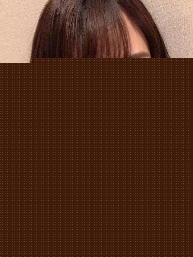 日本妹子因長得丑被欺凌，花400萬整成美女，神似“有村架純”
