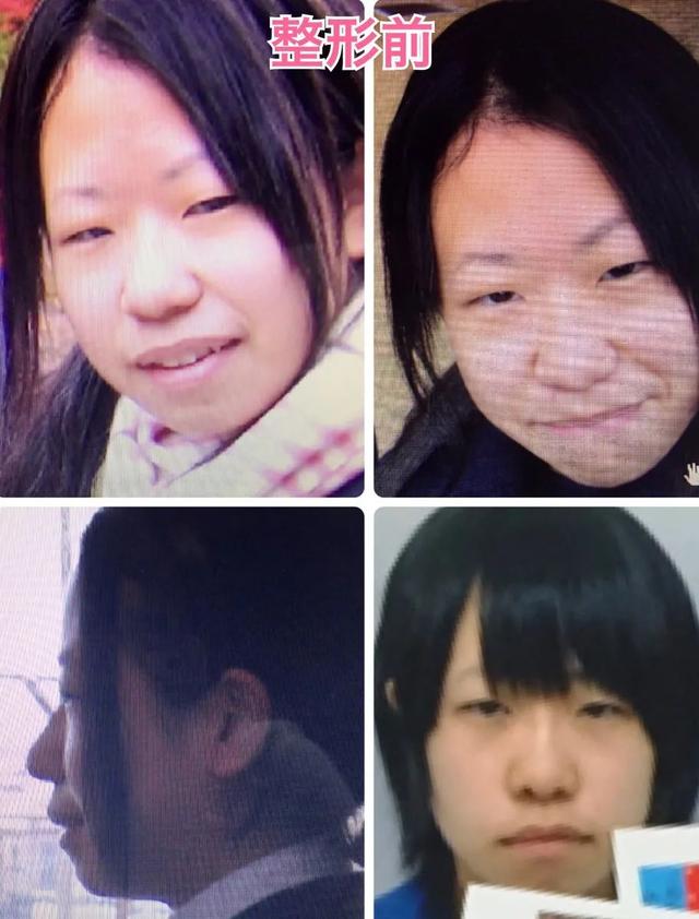 日本妹子因長得丑被欺凌，花400萬整成美女，神似“有村架純”