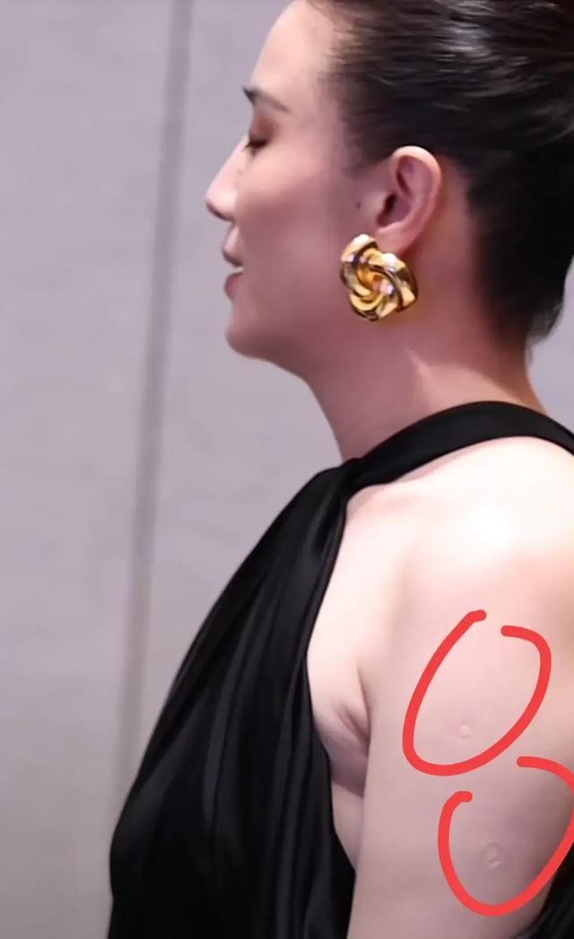 43歲宋佳近照！腋下婦乳明顯，真空禮服險(xiǎn)走光，胳膊上痕跡引熱議