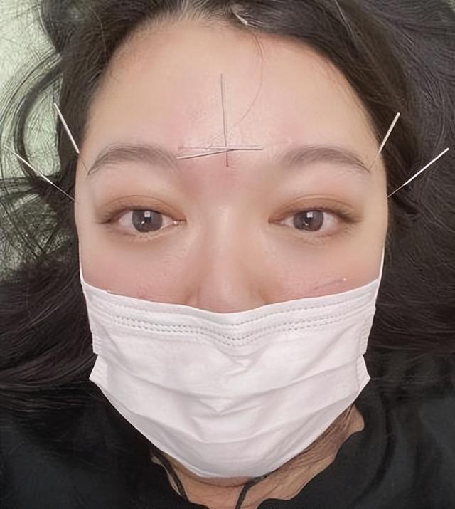 終究是物是人非！前港姐李珊珊患病多年，如今身材臃腫仍單身